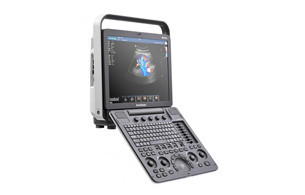 УЗИ аппарат SonoScape S8 Exp