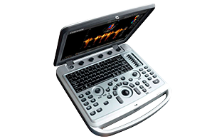 УЗИ аппарат Chison SonoTouch 50 (ECO 6)