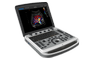 Chison SonoTouch 80 (SonoBook 6)